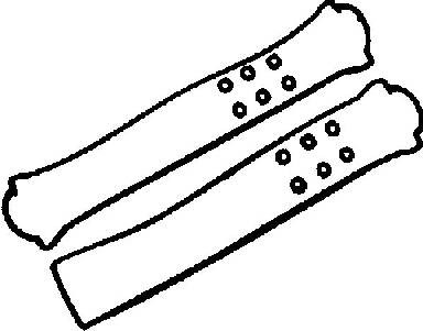 VICTOR REINZ Dichtungssatz, Zylinderkopfhaube