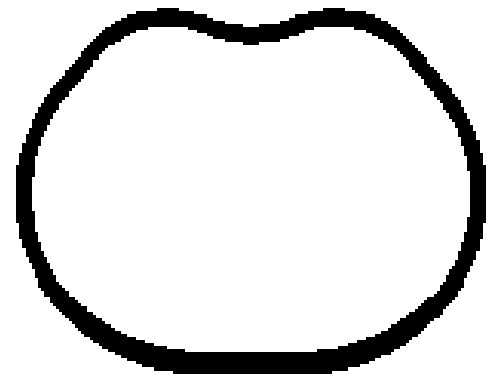 BGA Dichtung, Ansaugkrümmer